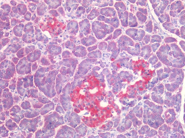 Figure 6. Immunostaining of human formalin fixed, paraffin embedded tissue sections with islets of Langerhans in the pancreas using 0566P (diluted 1:400), showing the specific pattern of NCAM/CD56 in the neuroendocrine cell types. As expected, no reactivity is seen in the epithelial cell compartment or connective tissue